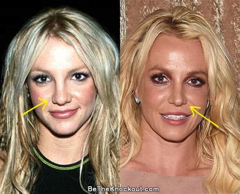 britney spears original nose|Did Britney Spears Get Plastic Surgery Over The。